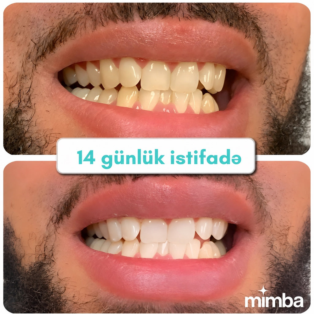 Mimba Diş Ağardıcı Stripları - ABŞ-da hazırlanmış formula 🇺🇸