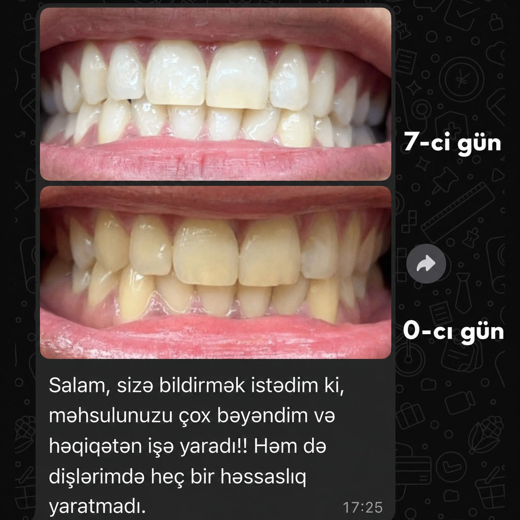 Mimba Diş Ağardıcı Stripları - ABŞ-da hazırlanmış formula 🇺🇸