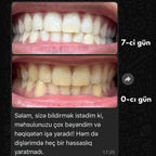 Mimba Diş Ağardıcı Stripları - ABŞ-da hazırlanmış formula 🇺🇸