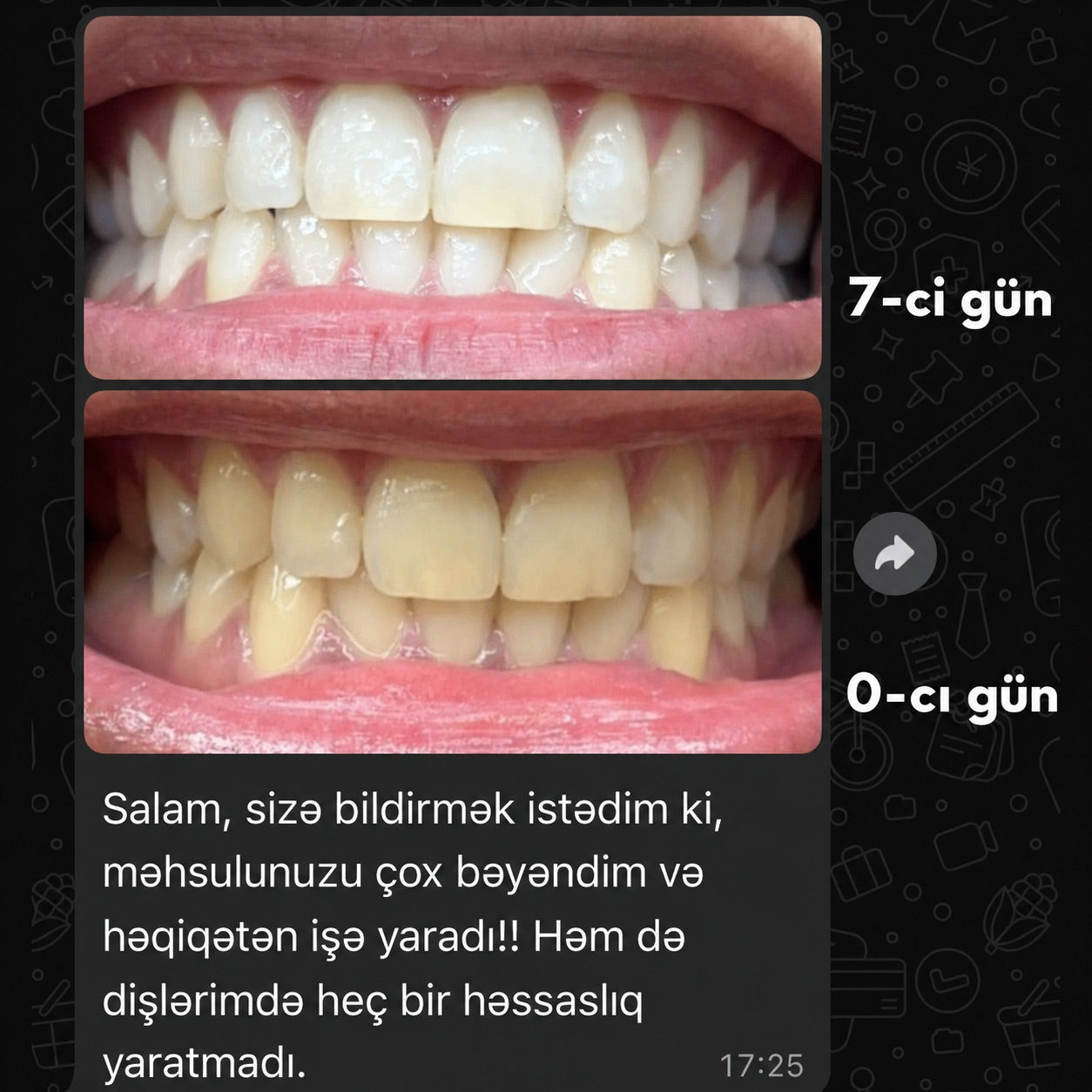Mimba Diş Ağardıcı Stripları - ABŞ-da hazırlanmış formula 🇺🇸