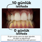 Mimba Diş Ağardıcı Stripları - ABŞ-da hazırlanmış formula 🇺🇸