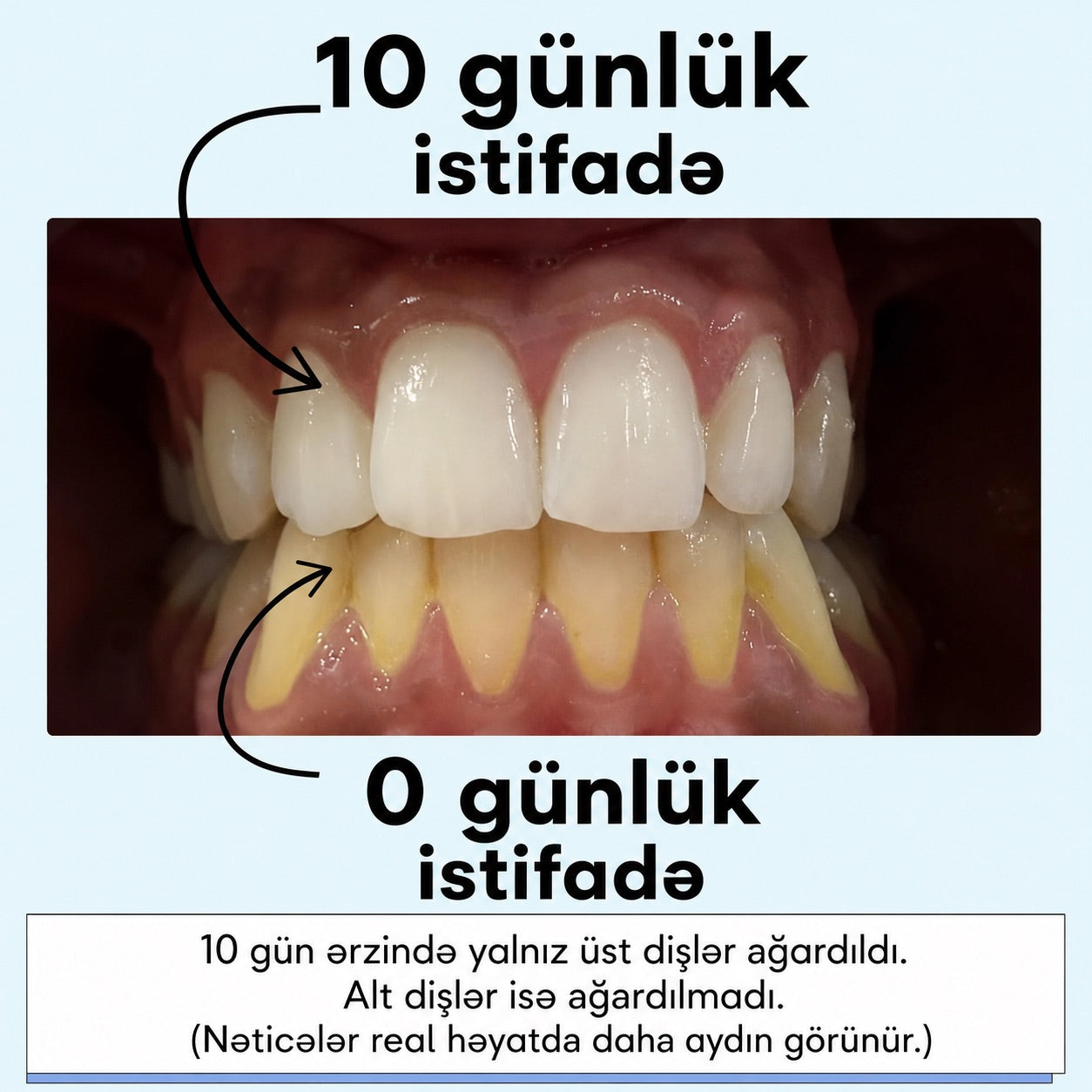 Mimba Diş Ağardıcı Stripları - ABŞ-da hazırlanmış formula 🇺🇸